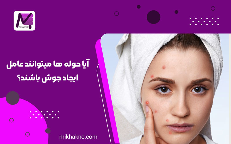 آیا حوله ها میتوانند عامل ایجاد جوش باشند؟,حوله و جوش
